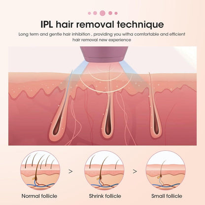 ✨ IPL Hair Removal Device for Women & Men – 999,900 Flashes | Permanent Hair Remover for Face, Arm, Leg, Bikini, and Full Body | Professional Laser Hair Removal at Home