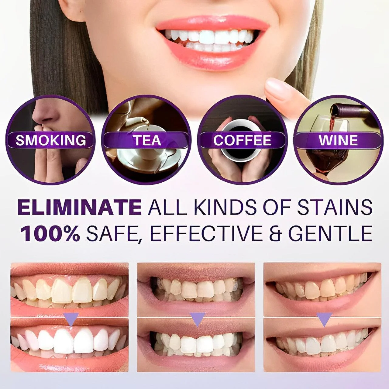 30ml Purple Teeth Whitening Purple White Teeth For Pain Sensitive Teeth Teeth Whitening